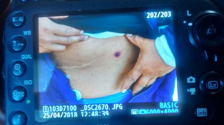 Un Mapuche resulta herido a bala por carabineros mientras defendía espacios sagrados en Trafún Panguipulli